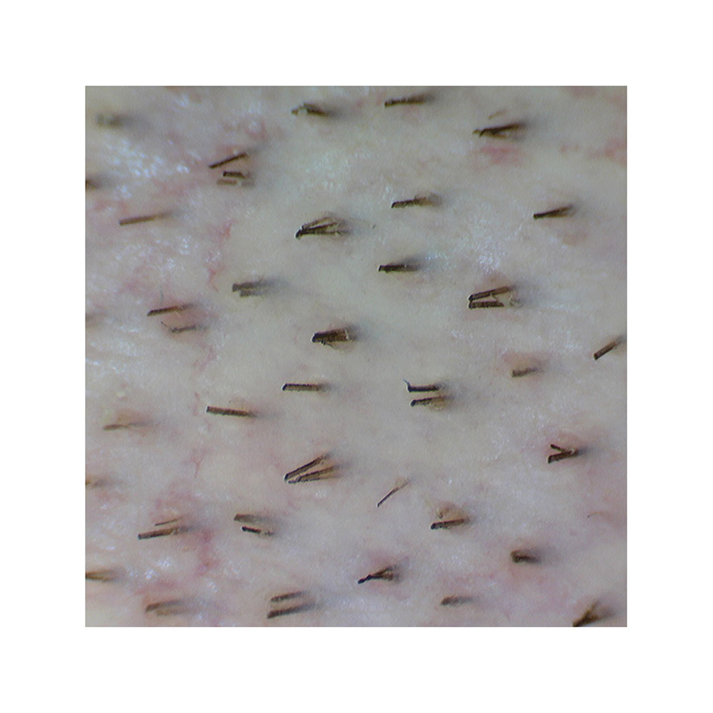 Beleuchtungsstärke und Fotoaufnahmen lassen sich am Dermatoskop steuern «Firefly» Videodermatoskop
