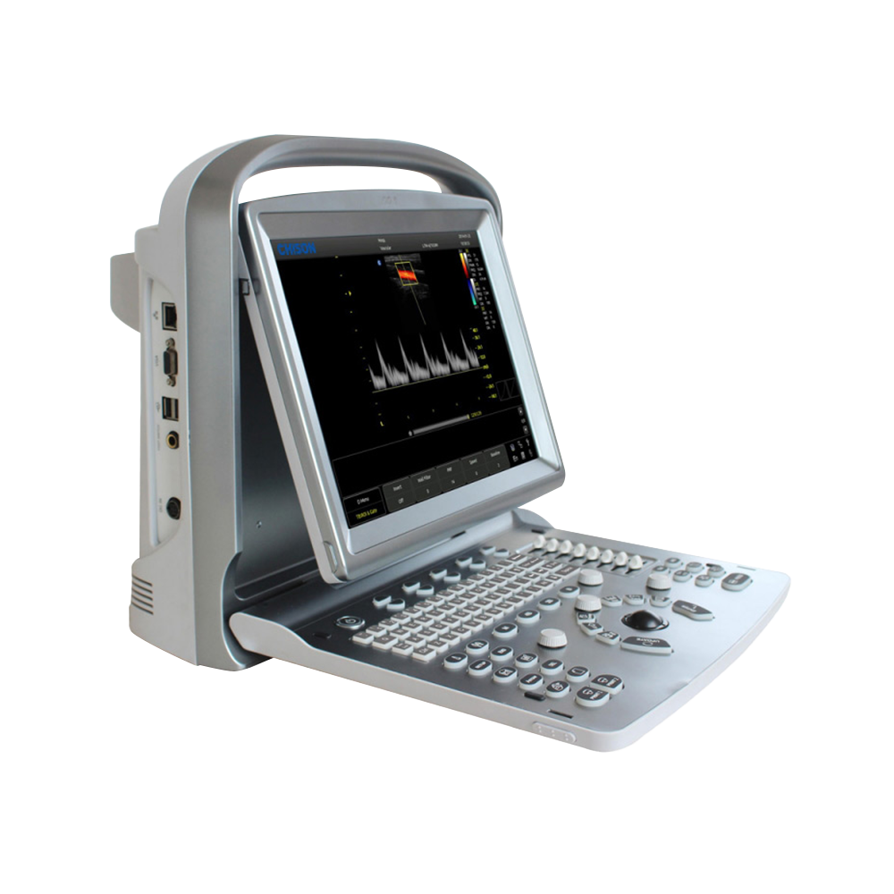 CHISON ECO5 Ultraschallgerät mit Farbdoppler & mehrsprachiger Software CHISON ECO5 Ultraschallgerät mit Farbdoppler