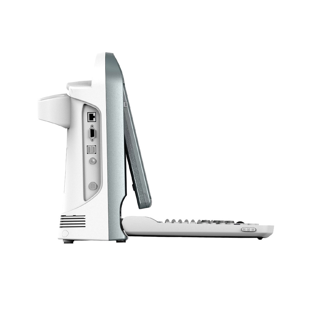 Anschlüsse: 1 Video-Out-Anschluss, 1 VGA-Anschluss, 3 USB-Anschlüsse, 1 LAN-Anschluss CHISON ECO5 Ultraschallgerät mit Farbdoppler