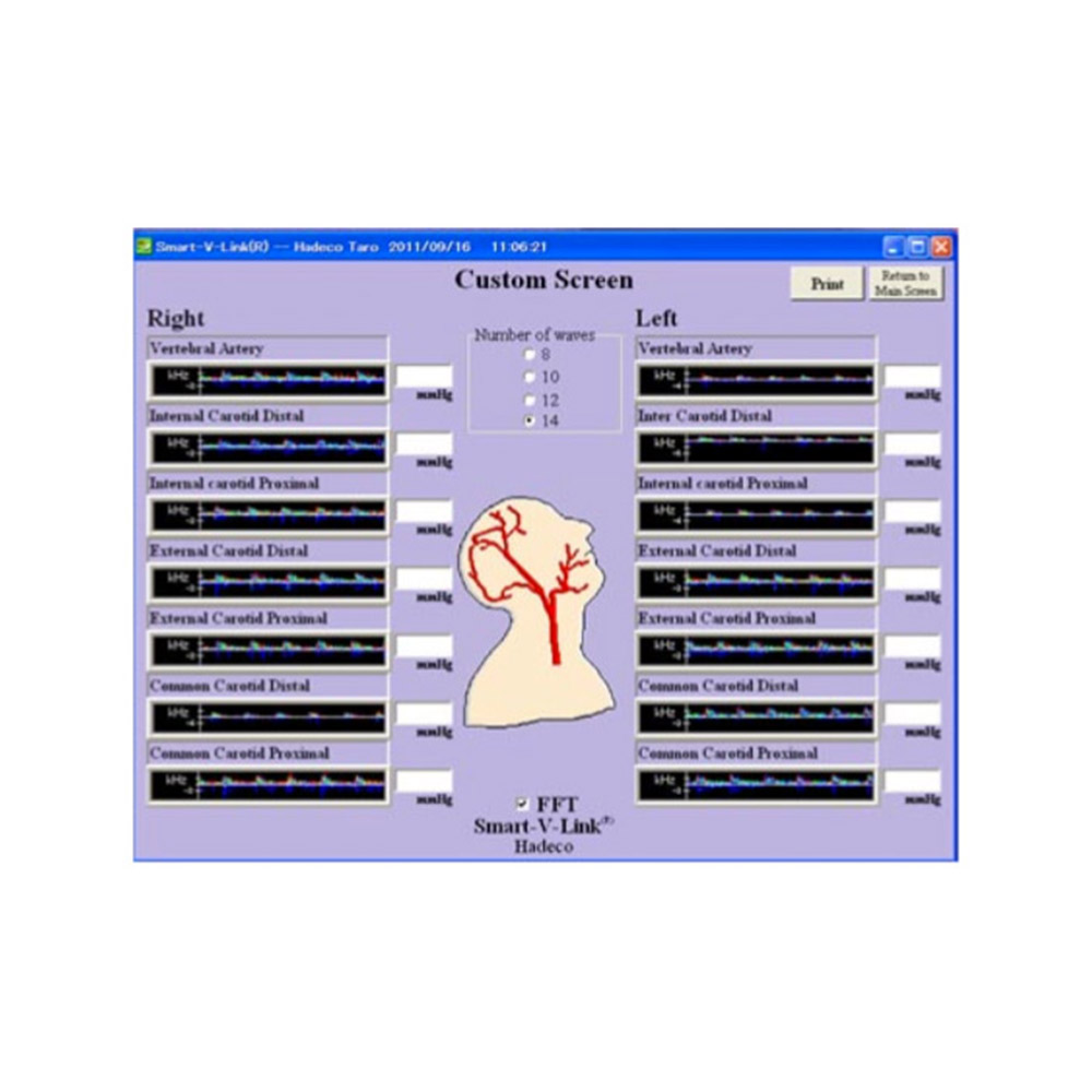 Smart-V-Link Software