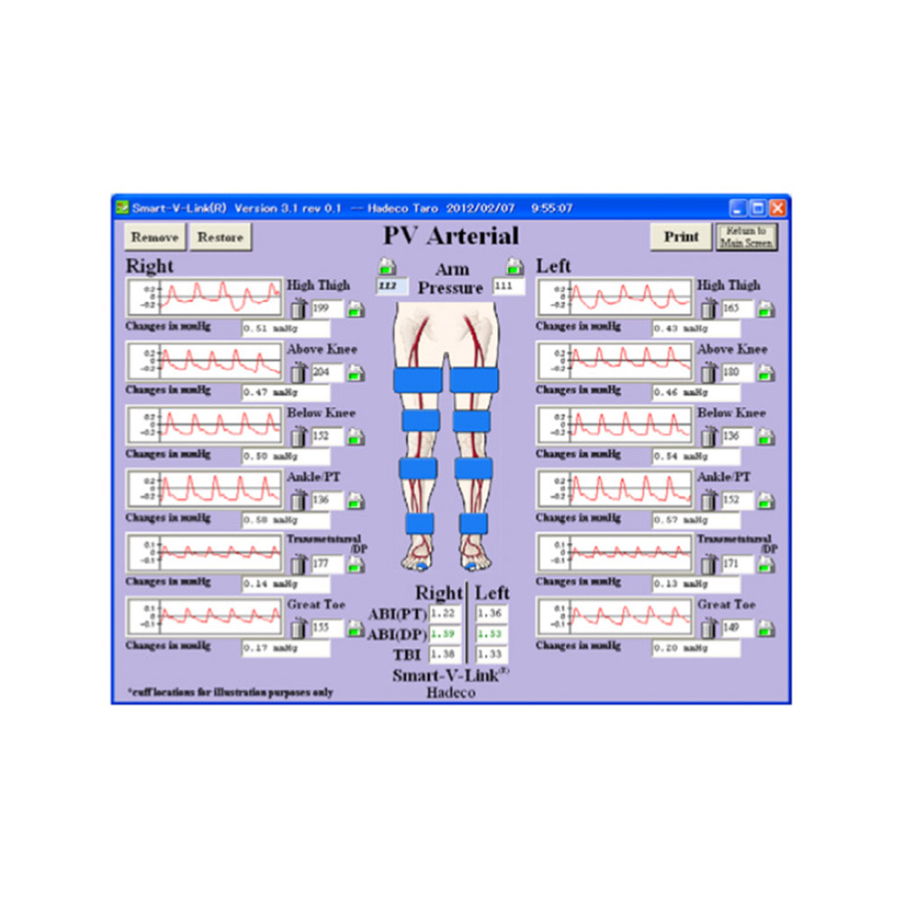 Smart-V-Link Software