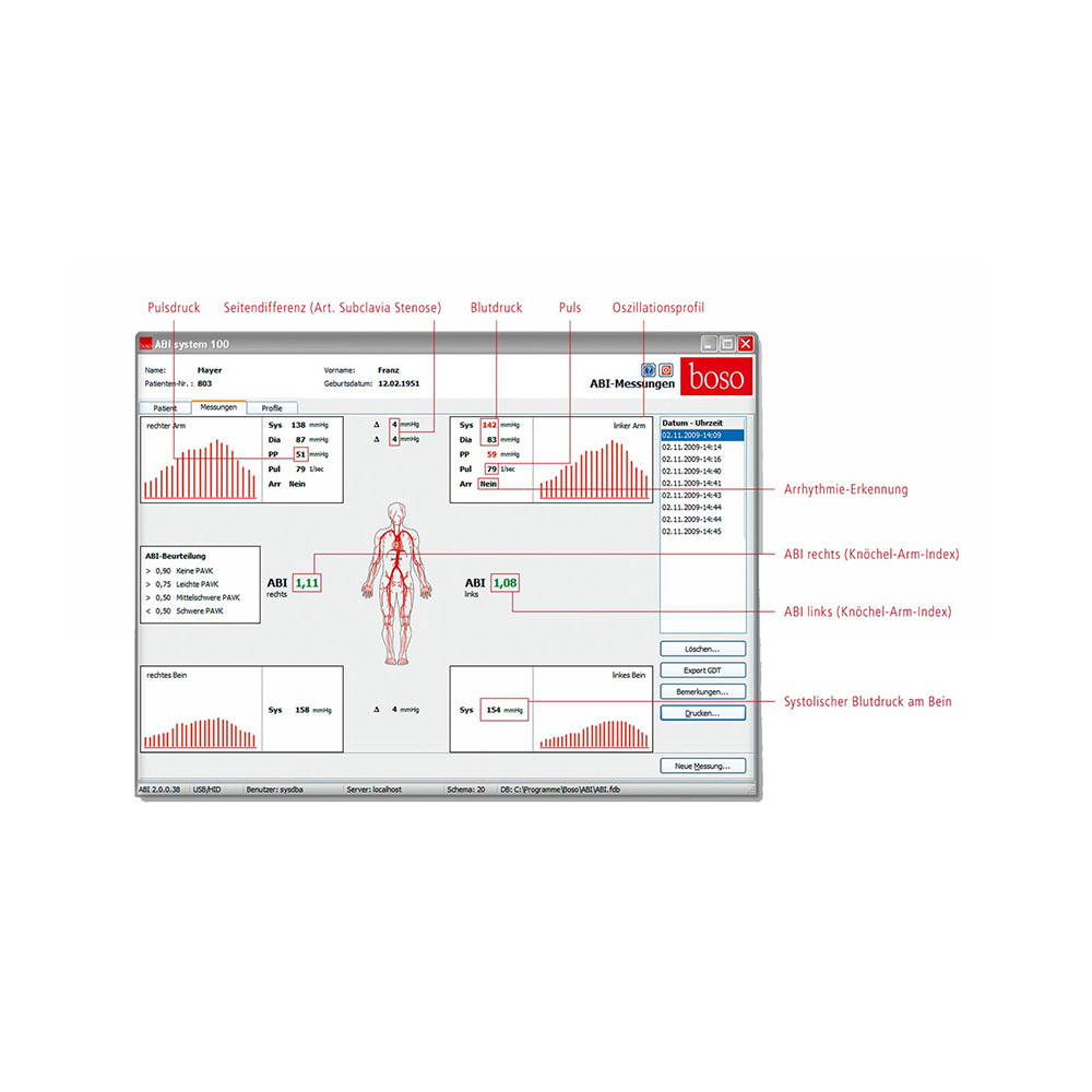 Graphische Oberfläche der Software des ABI-System 100 Messgeräts boso ABI-System 100