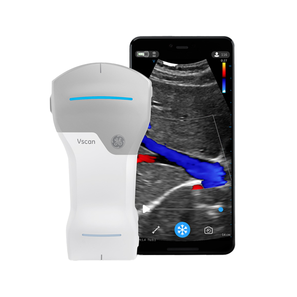 Diagnostisches Ultraschallgerät zum mobilen Einsatz  Vscan Air Ultraschallsystem