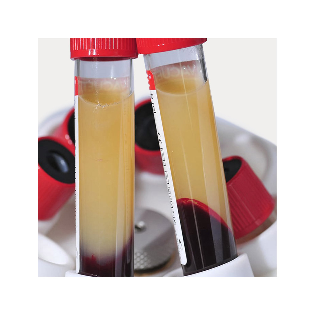 Zur Herstellung von PRP und ähnlichen Endprodukten zugelassen Medizinische Zentrifuge MEDIFUGE CGF