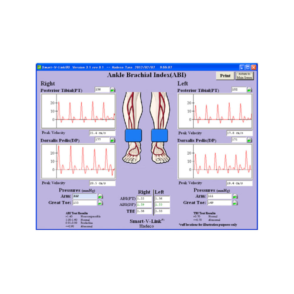 Smart-V-Link Software
