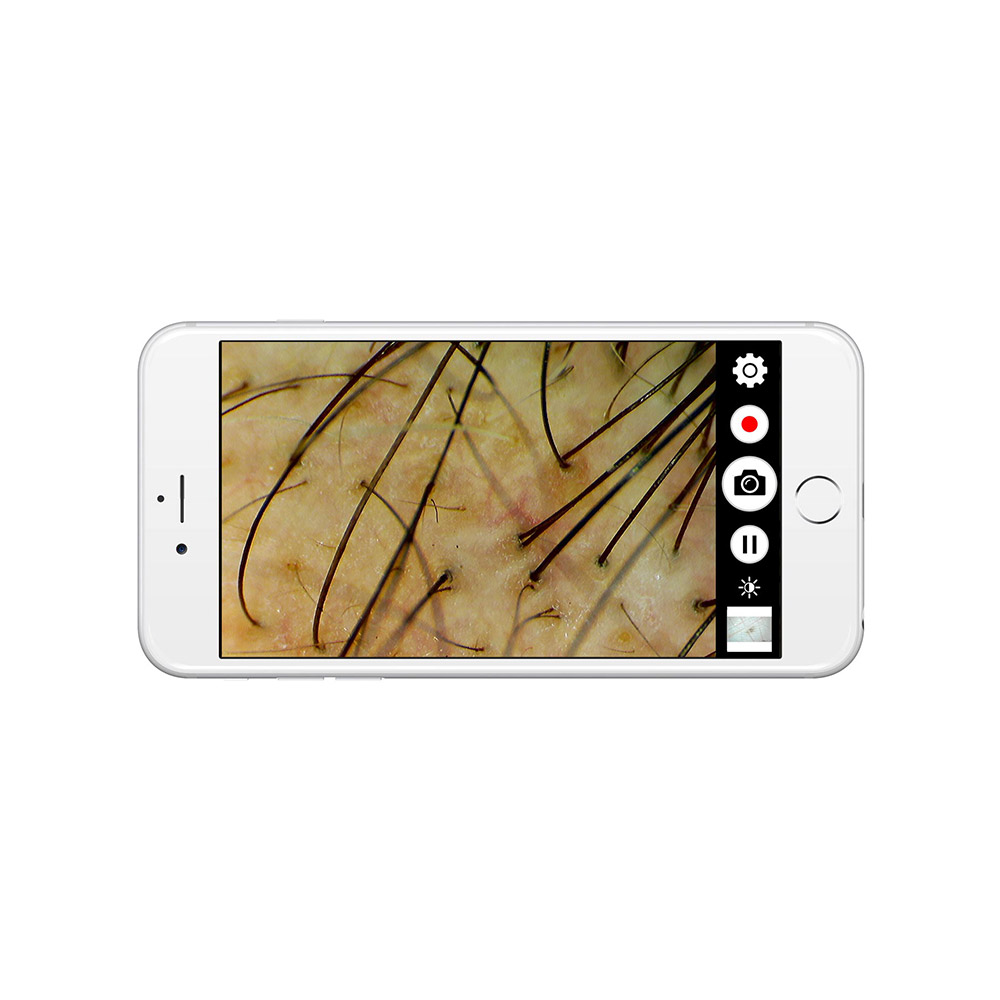 Datenübertragung an iOS- & Android-Geräte mit FireflyPro Dermatoscope-App Firefly DE370 W-LAN Digital-Dermatoskop
