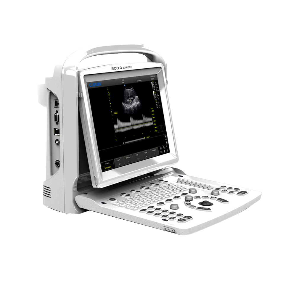 CHISON ECO3 Expert Ultraschallgerät mit 12-Zoll LED-Monitor CHISON ECO3 Expert Ultraschallgerät