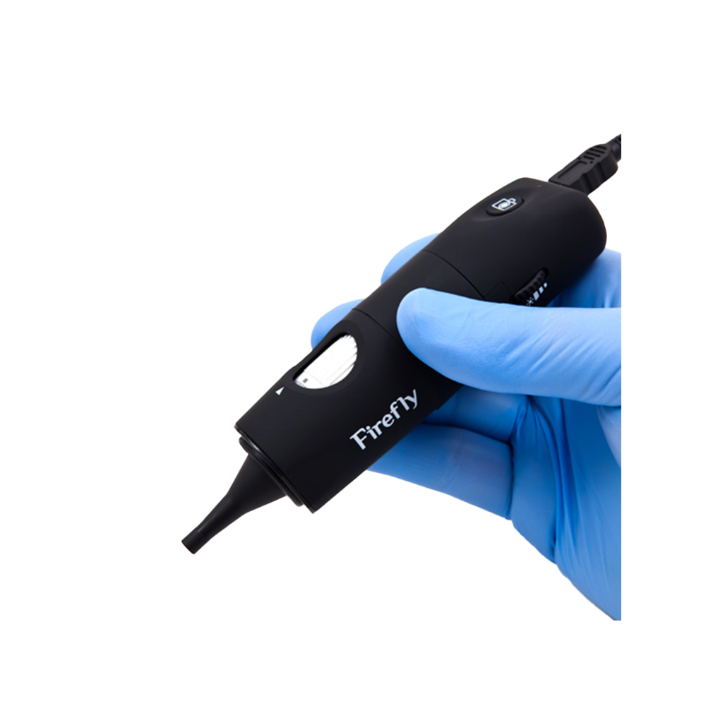 Video-Otoskop Firefly mit moderner LED-Beleuchtung (Helligkeit regulierbar) «Firefly» Video-Otoskop