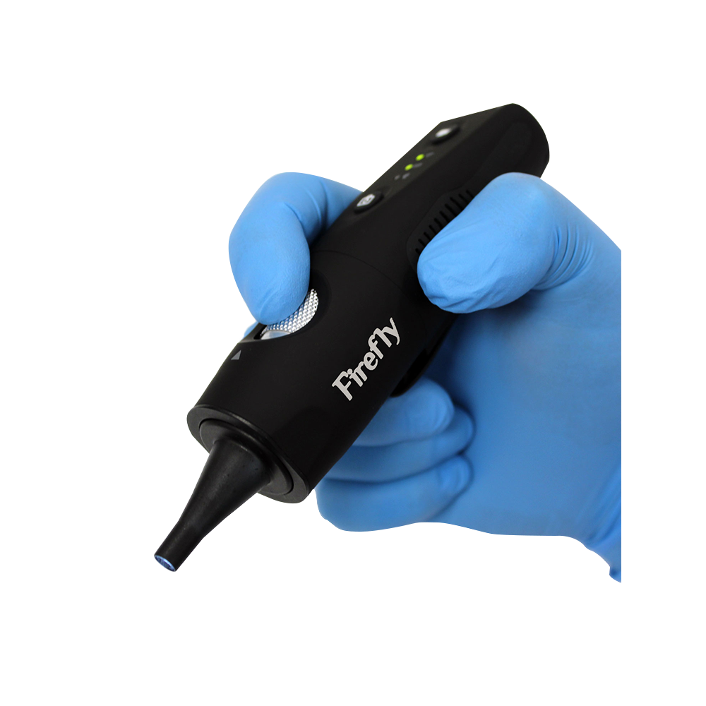 Firefly DE570 HD Digital-Otoskop mit WiFi, 4 LEDs und integriertem Akku Firefly DE570 W-LAN HD Digital-Otoskop
