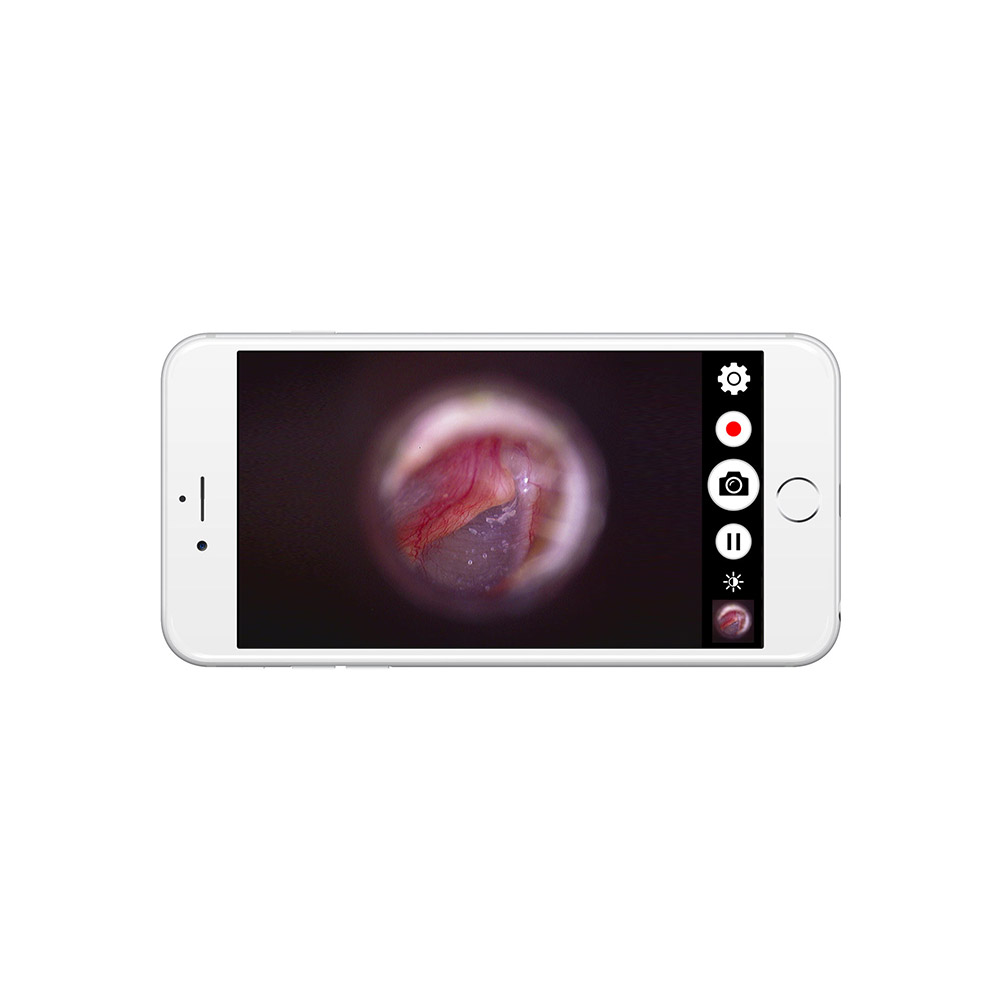 Kabellose Datenübertragung an kompatible iOS- und Android-Geräte Firefly DE570 W-LAN HD Digital-Otoskop