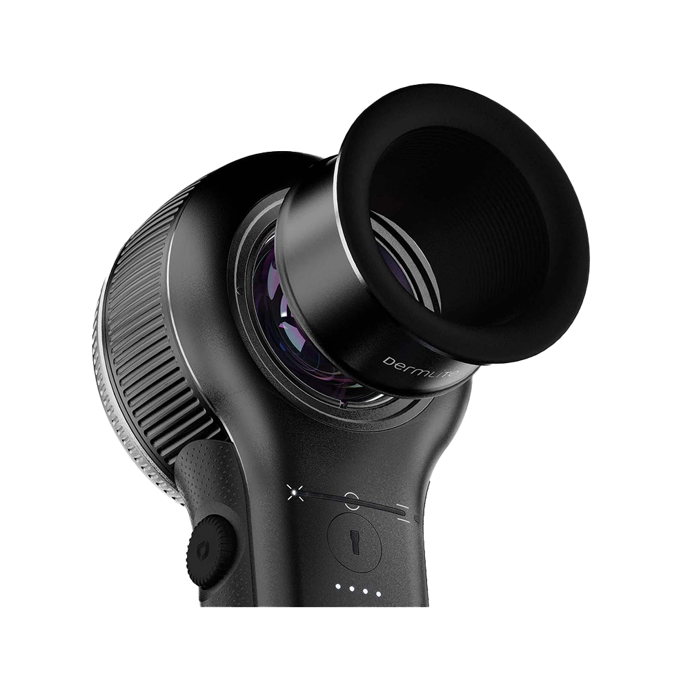 3GEN DermLite DL5 Okular 3GEN DermLite DL5 Okular