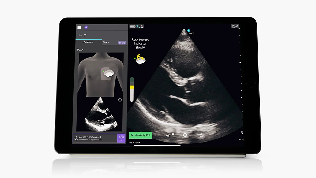 VScan Air SL Caption AI