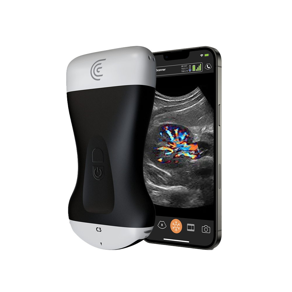 Clarius HD3 Ultraschallsystem, tragbar und flexibel Clarius HD3 Ultraschallsystem