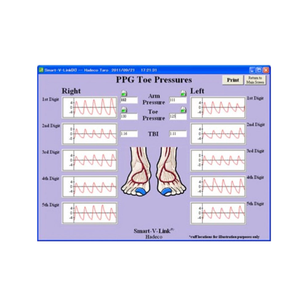 Smart-V-Link Software