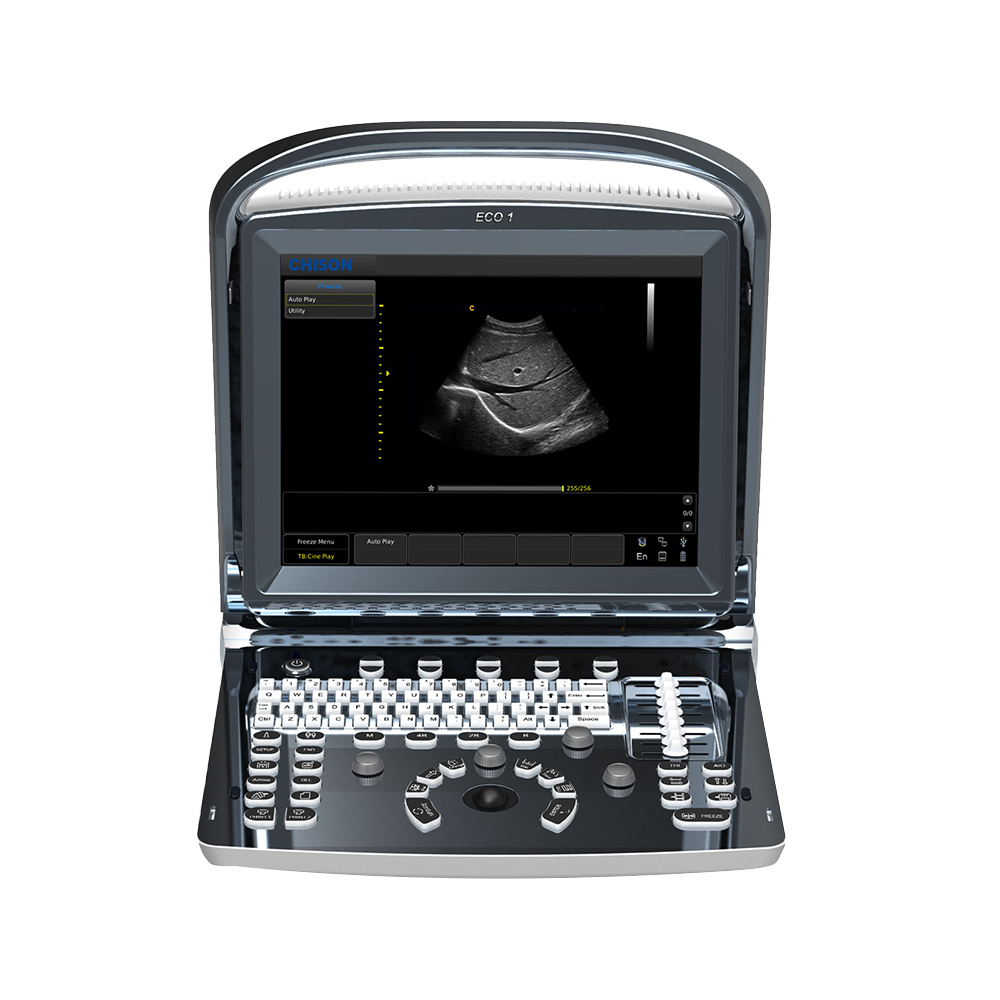 Chison ECO 1 Ultraschallgerät mit neigbarem 12-Zoll S/W-Monitor Chison ECO 1 Ultraschallgerät